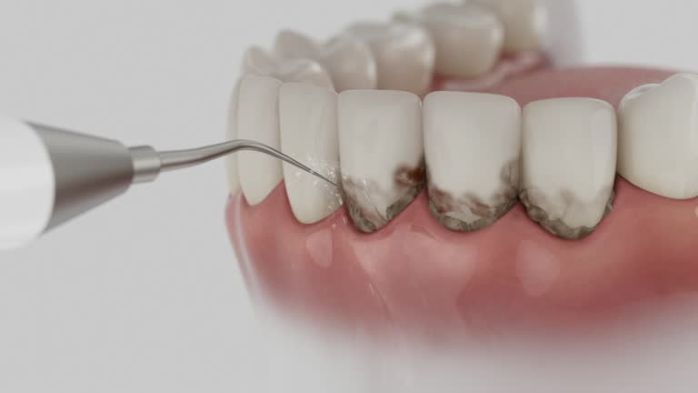 Reliable Teeth Cleaning And Checkup contractor in Hot Springs County County, WY by Dentist Open Now